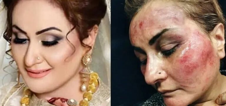 Nargis Allegedly Assaulted by Husband